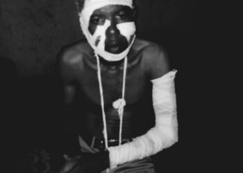 Buterere : Hassan Bukuru l’échappe belle